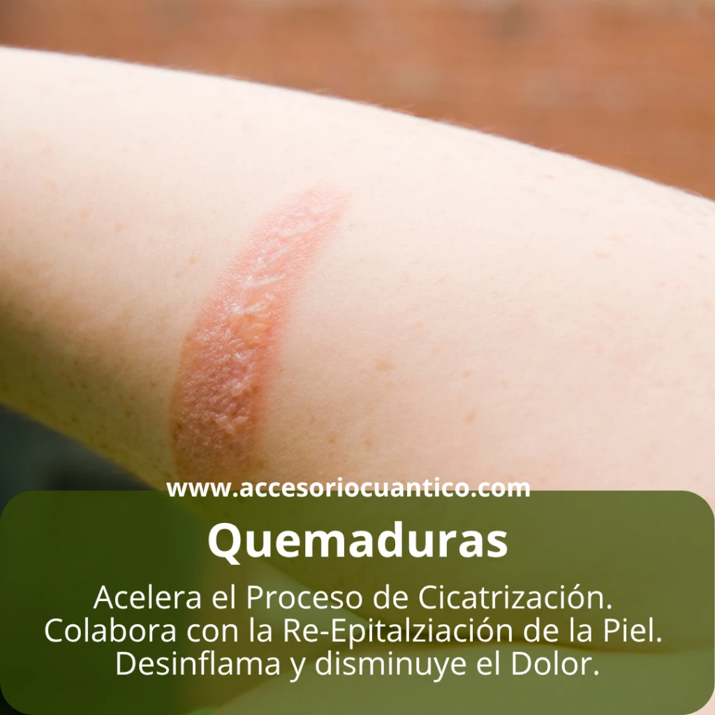 10.webp