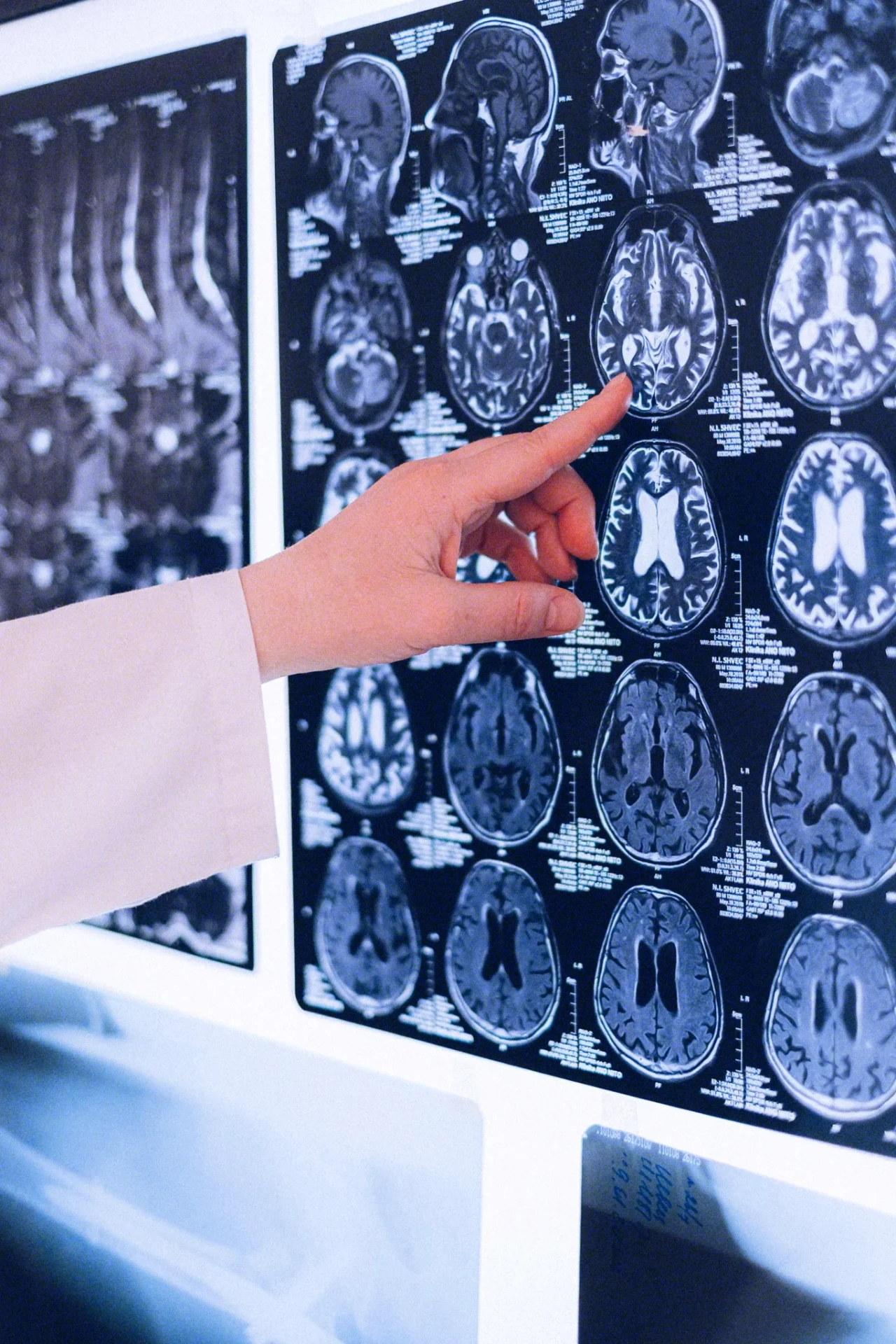 En RMN Imagen nos especializamos en resonancia magnética. Brindamos estudios confiables y precisos de articulaciones, cerebro y columna, con tecnología avanzada y un enfoque en tu salud y bienestar